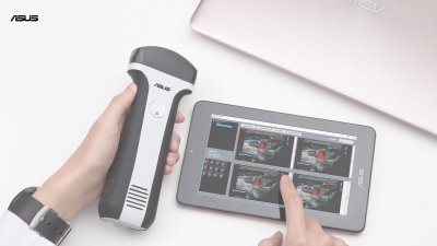 ASUS Portable Ultrasound Solution