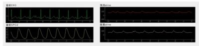 Kaohsiung Medical University| A timely prediction system for non-invasive alternative arterial pressure waveforms