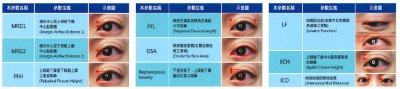 Kaohsiung Medical University| Automatic Blepharoptosis Detection System